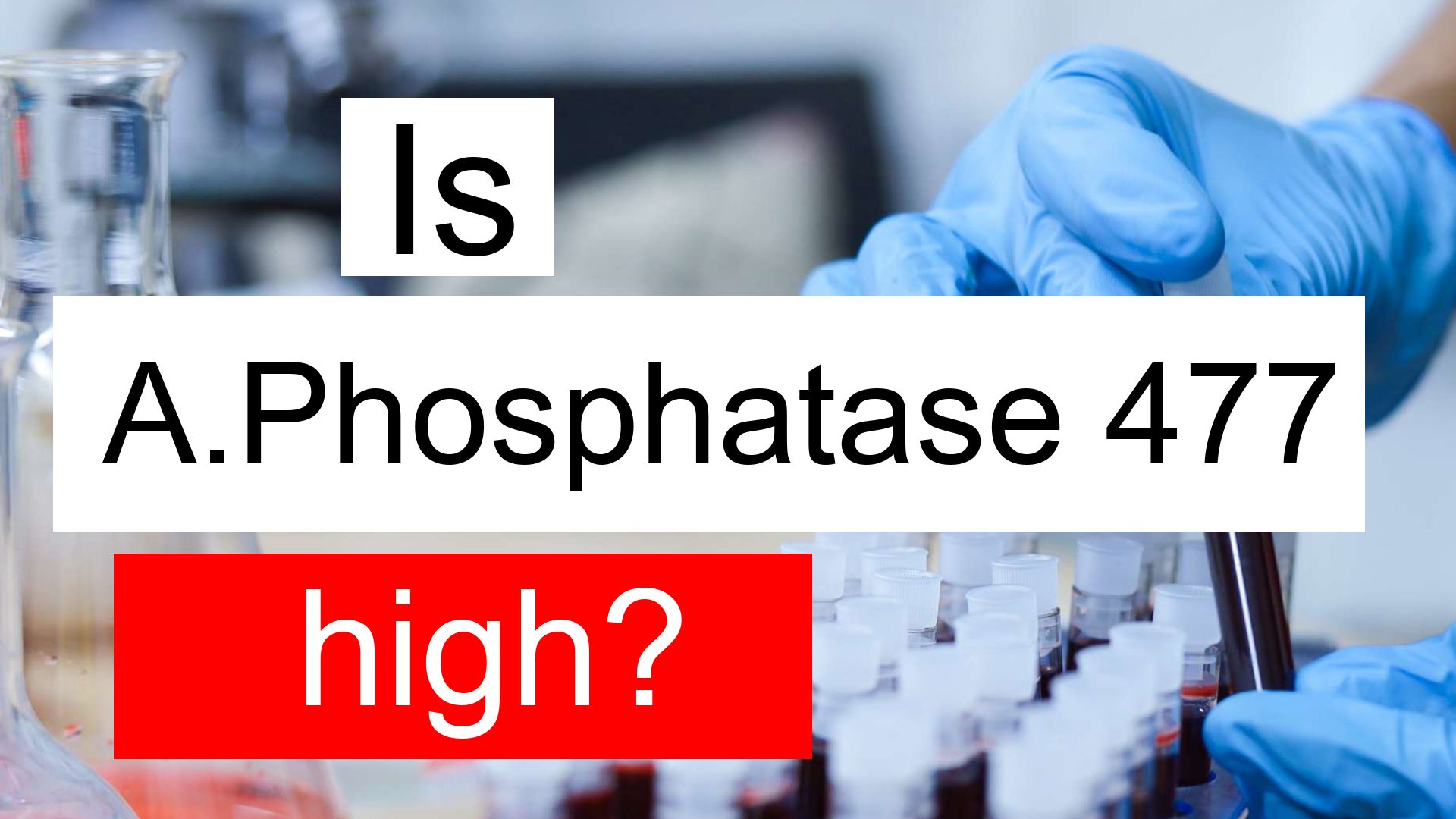 is-triglycerides-477-high-normal-or-dangerous-what-does-triglycerides