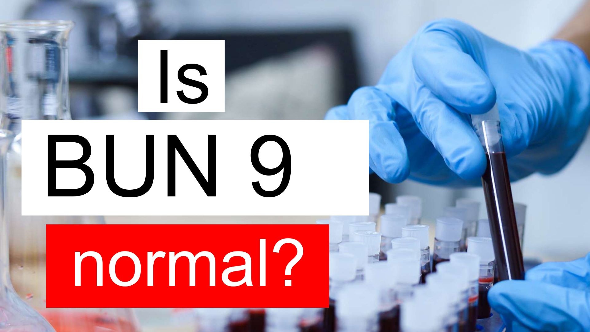 is-bun-9-normal-high-or-low-what-does-blood-urea-nitrogen-level-9-mean