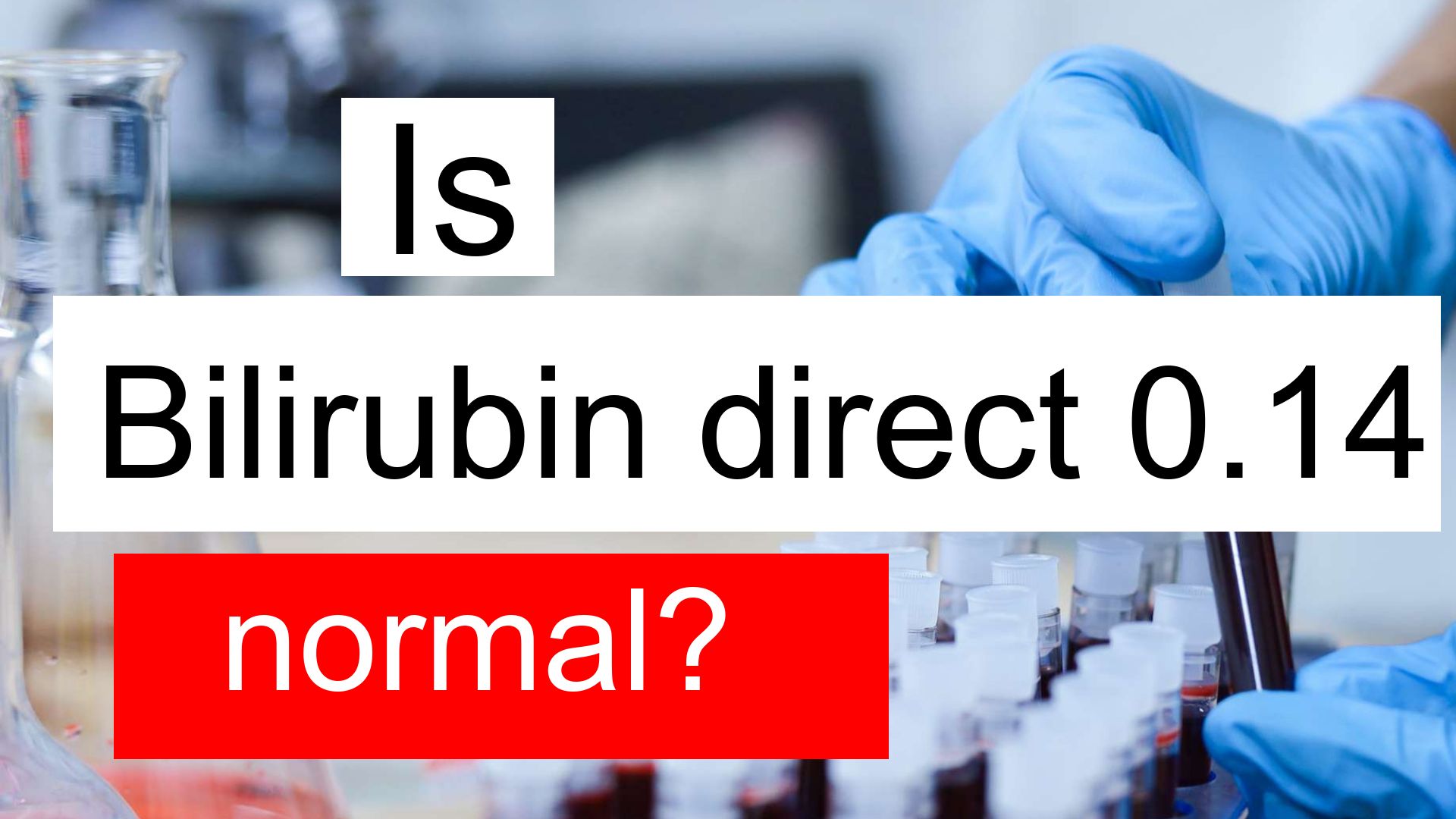 is-bilirubin-direct-0-14-normal-high-or-low-what-does-bilirubin