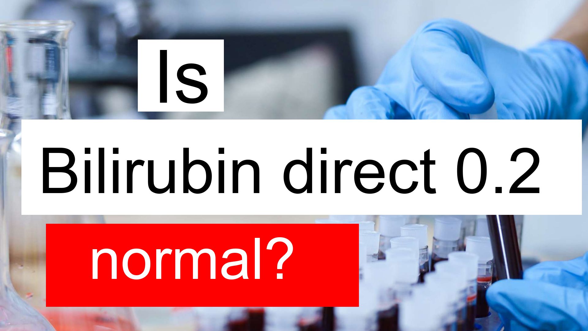 Why My Direct Bilirubin Is High