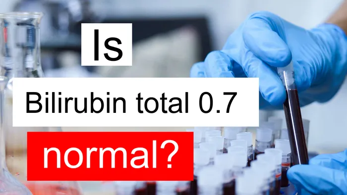 Bilirubin total 0.7