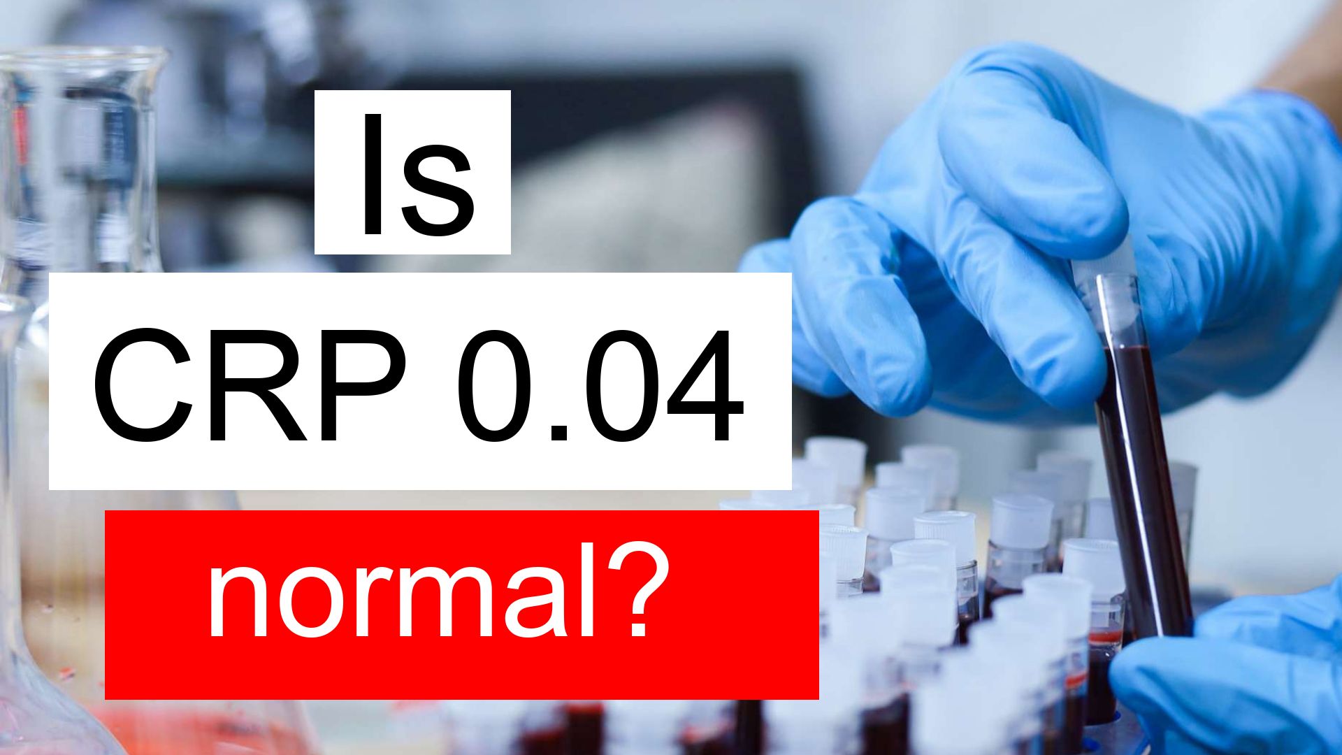 Is CRP 0 04 Normal High Or Low What Does C Reactive Protein Level 0 