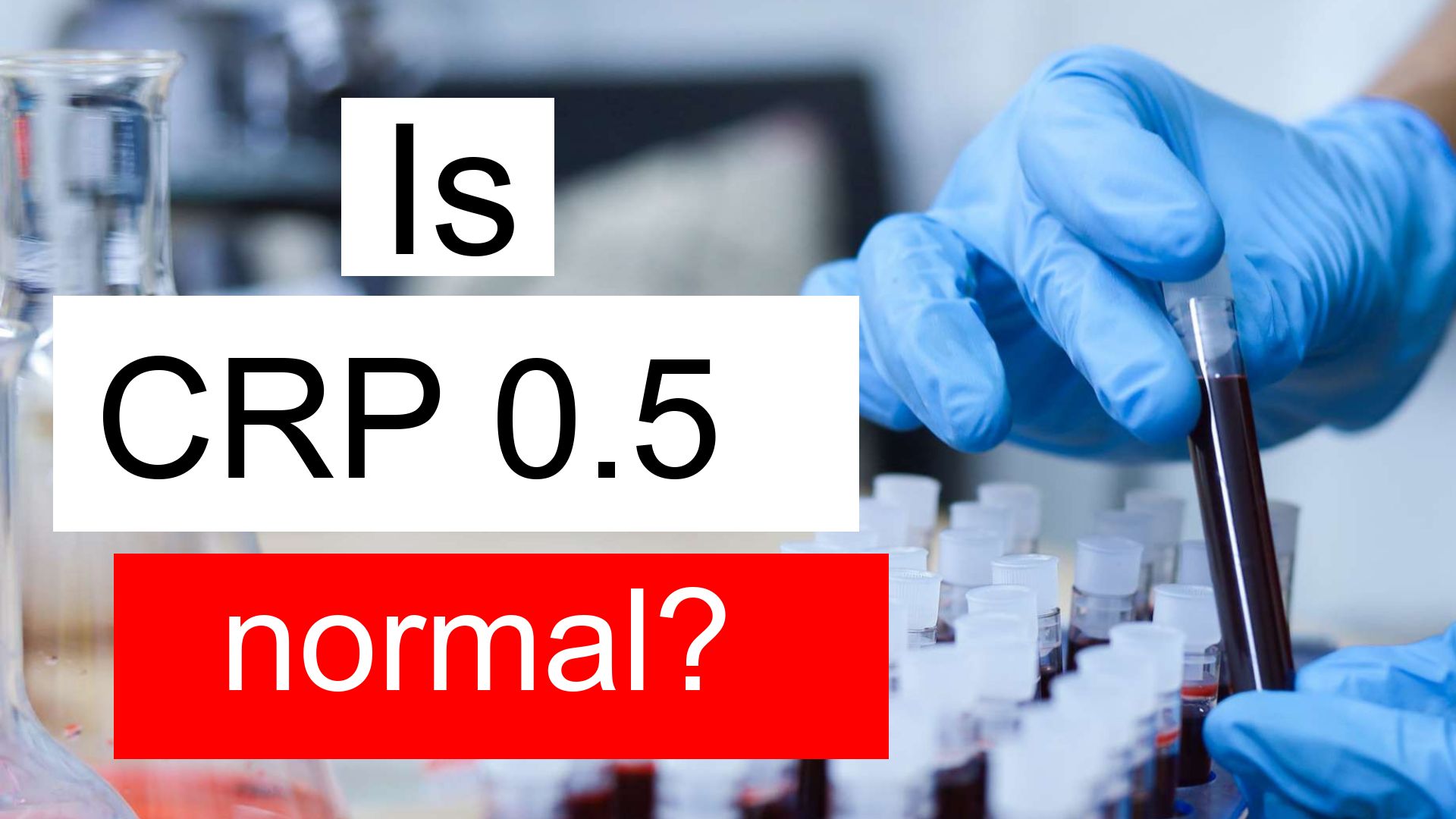 High Platelet Count Normal Crp