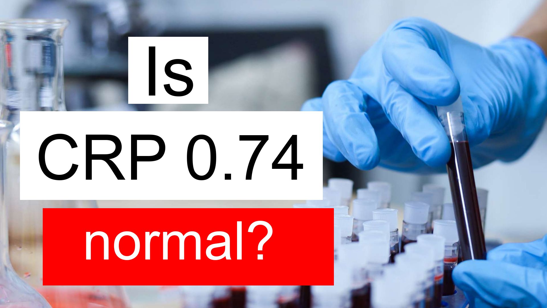 Is CRP 0 74 Normal High Or Low What Does C Reactive Protein Level 0 