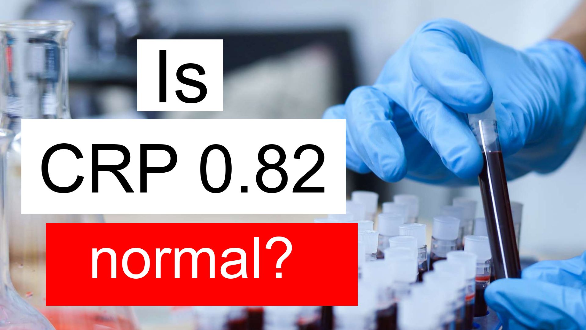 is-crp-0-82-normal-high-or-low-what-does-c-reactive-protein-level-0