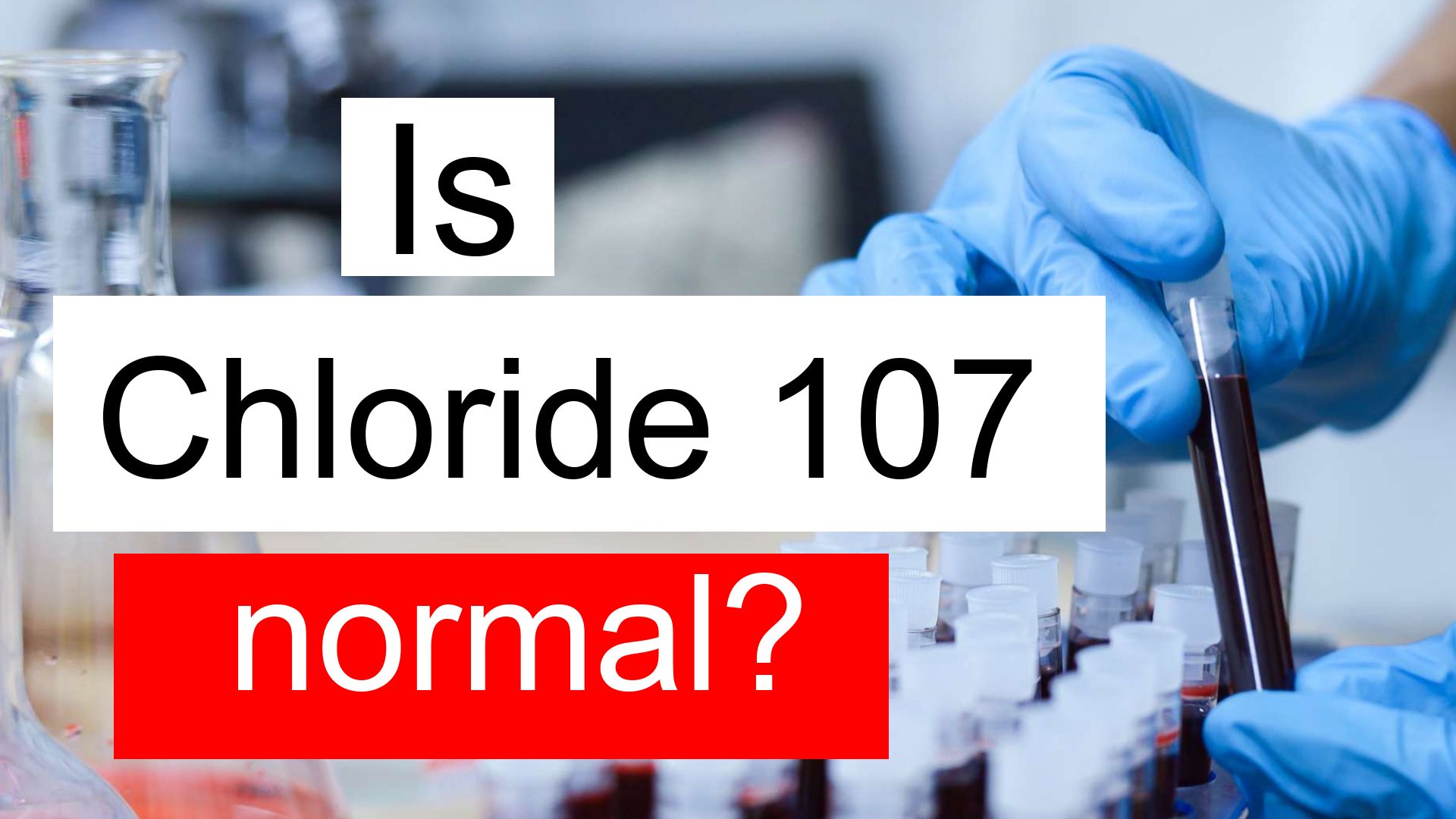 is-chloride-107-normal-high-or-low-what-does-chloride-level-107-mean