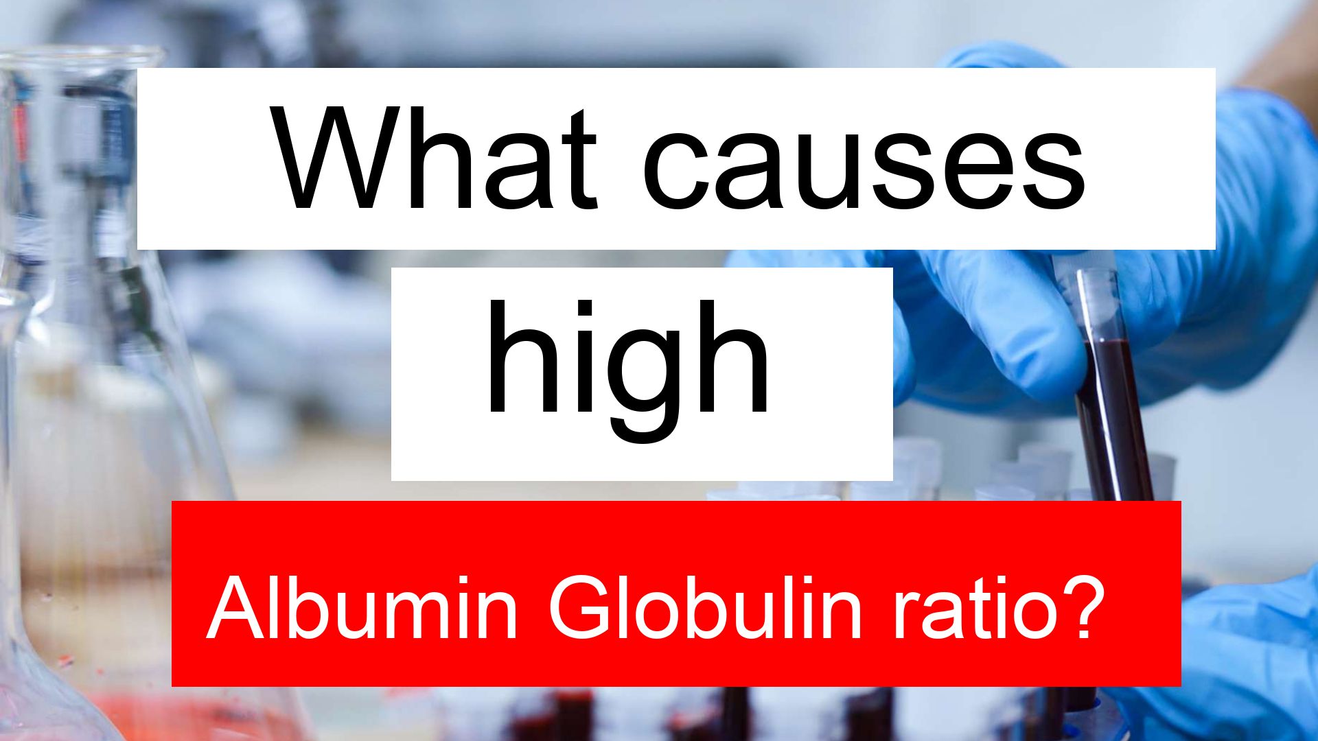 What causes high Albumin Globulin ratio and low TSH 3?