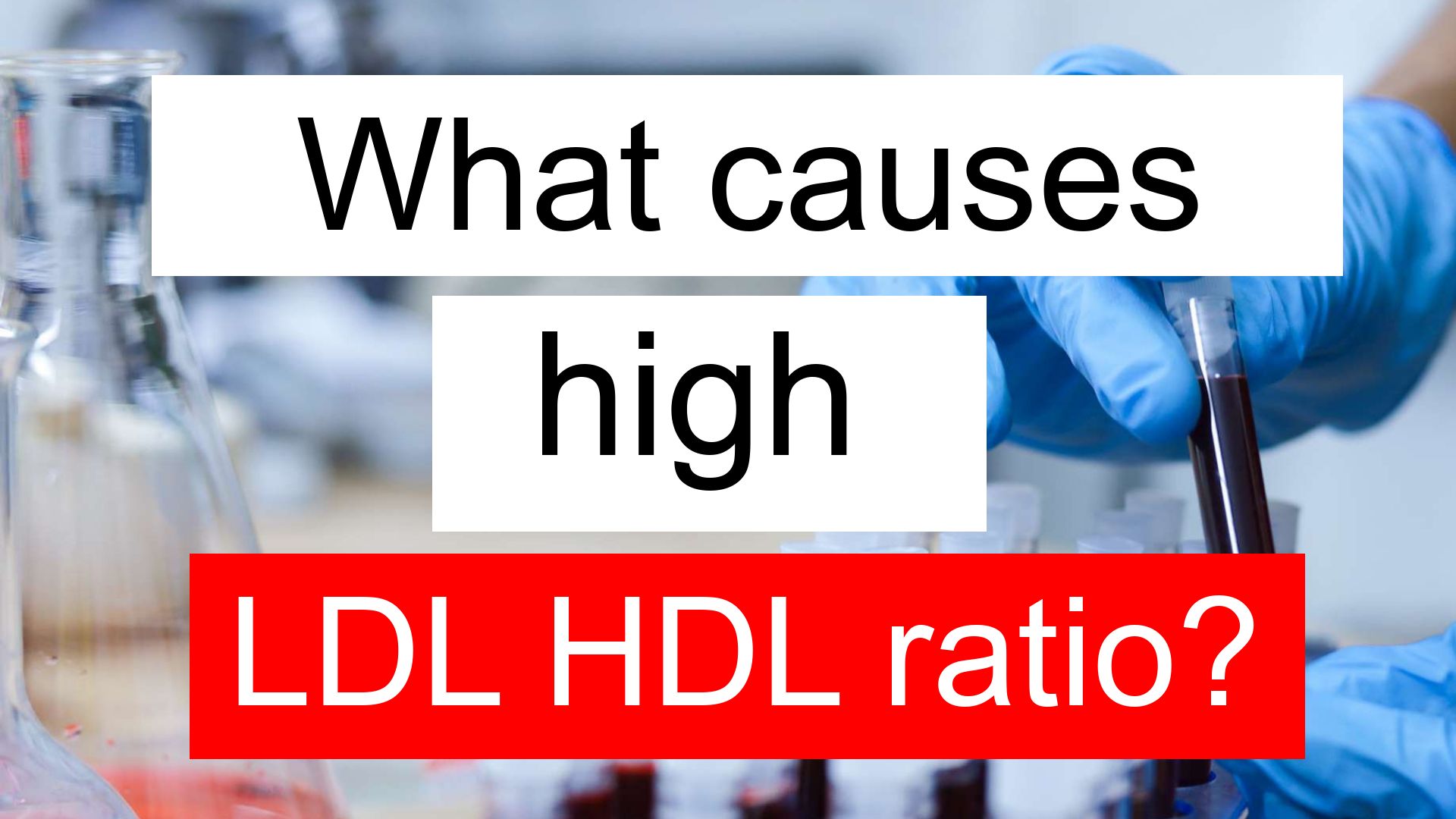 cholesterol-test-lipid-profile-test-lipid-panel-test-youtube