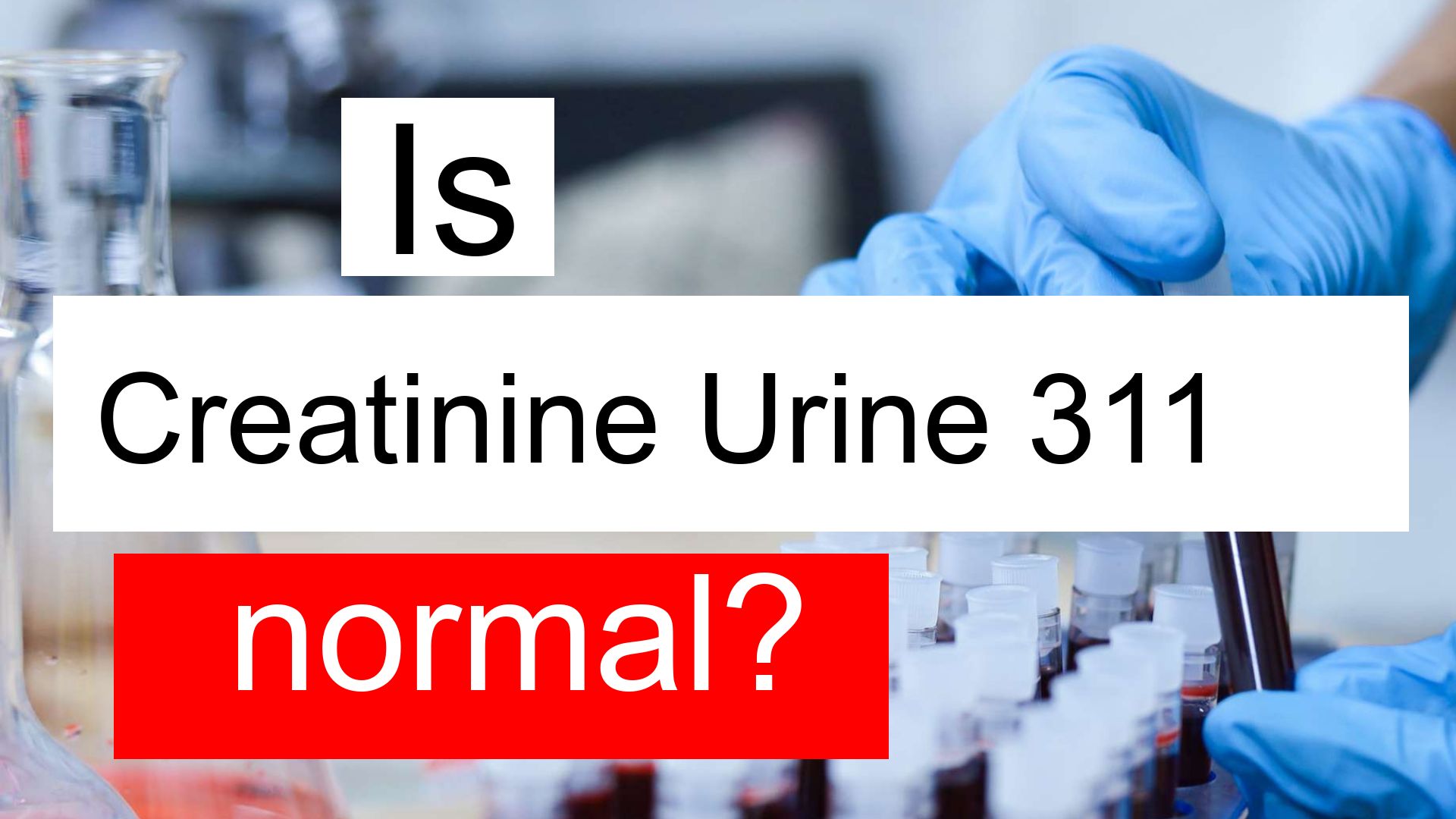 is-creatinine-urine-311-normal-high-or-low-what-does-creatinine-urine