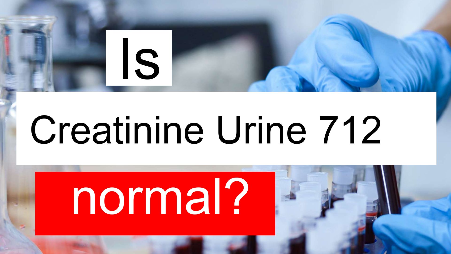 is-creatinine-urine-712-high-normal-or-dangerous-what-does-creatinine