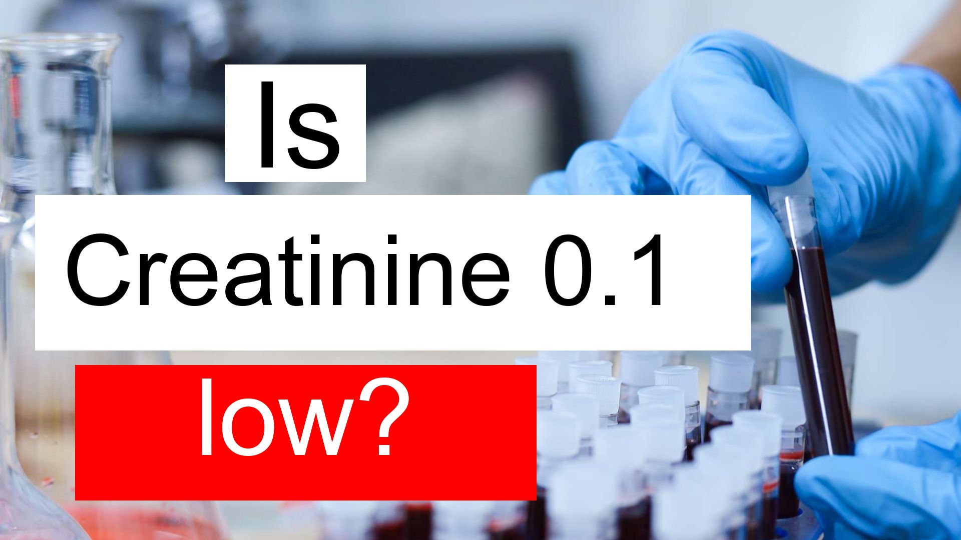 is-creatinine-0-1-low-normal-or-dangerous-what-does-creatinine-level