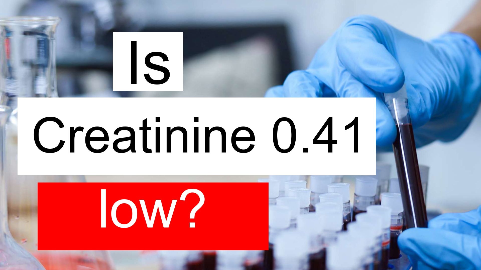 How Much Does Creatinine Fluctuate