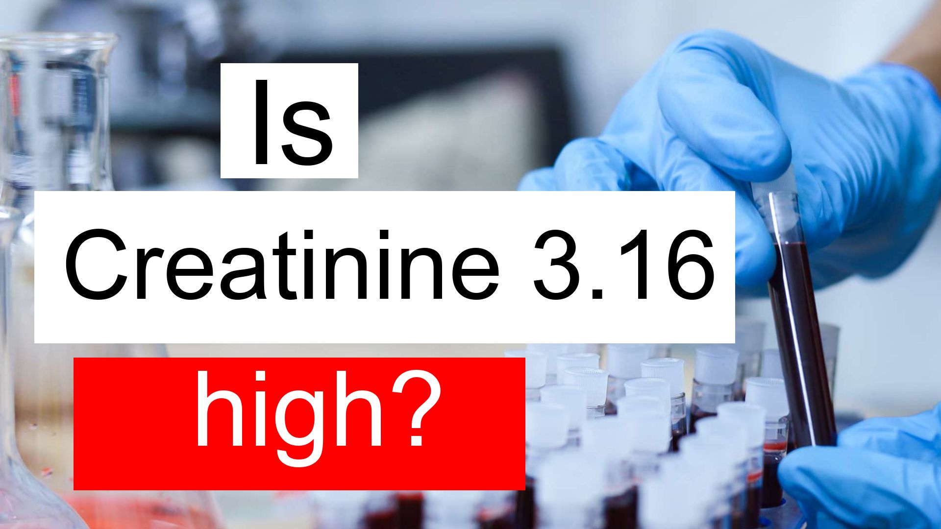 is-creatinine-3-16-high-normal-or-dangerous-what-does-creatinine