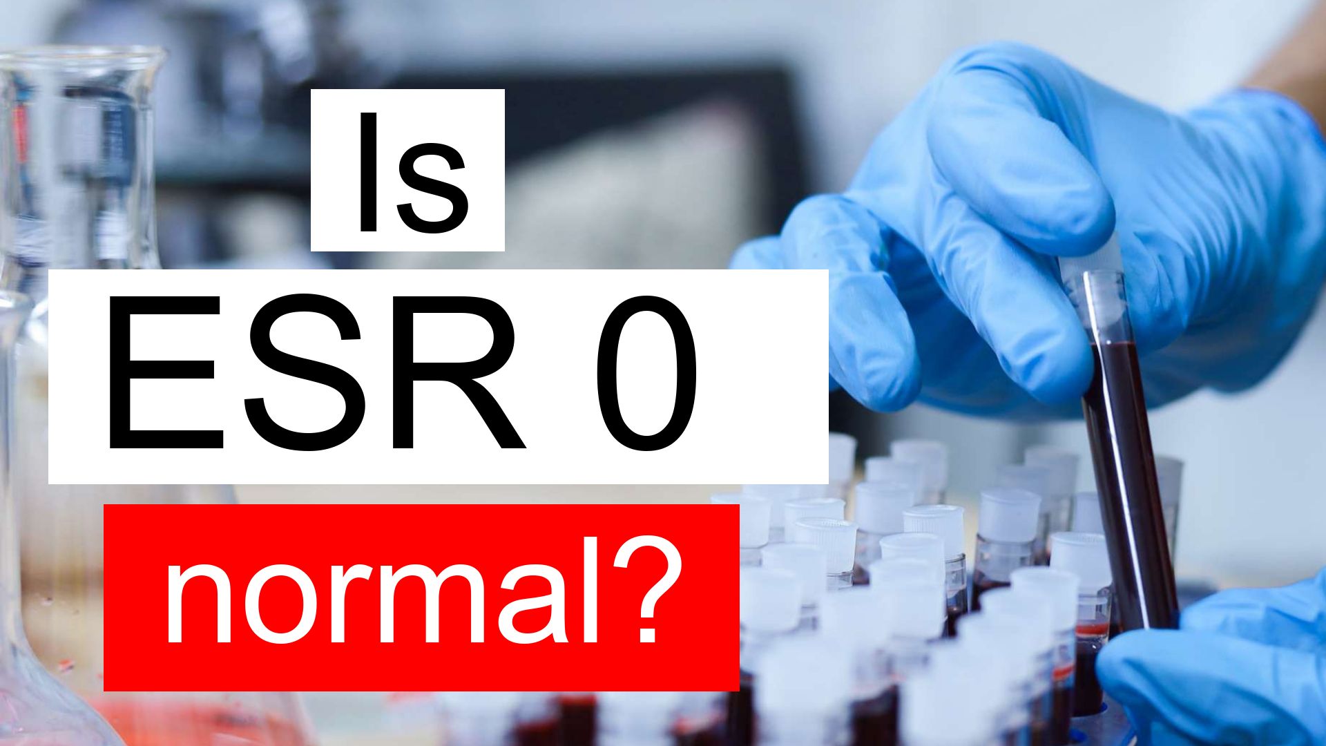 is-esr-0-normal-high-or-low-what-does-esr-level-0-mean