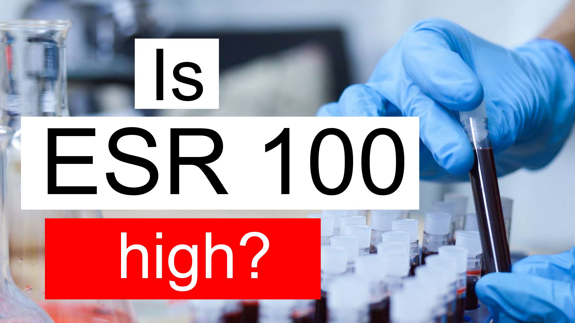 is-esr-100-high-normal-or-dangerous-what-does-esr-level-100-mean