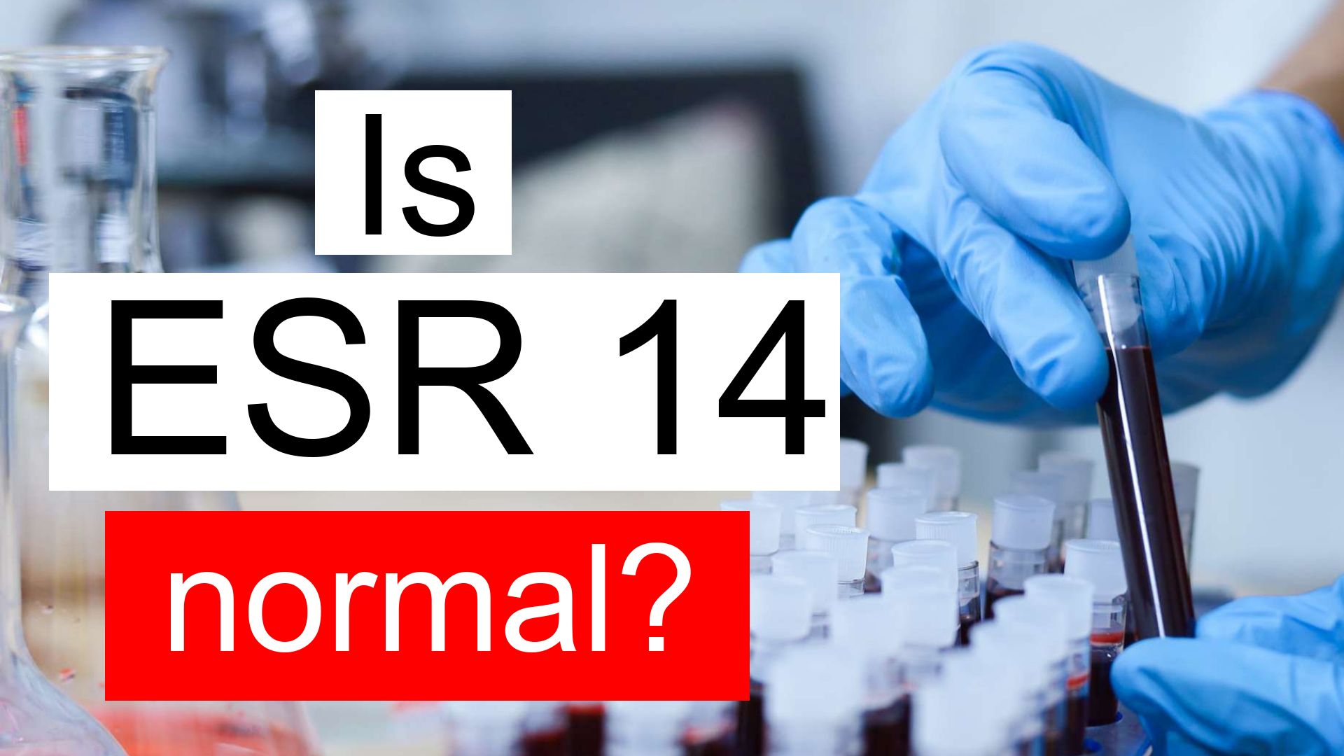 is-esr-14-normal-high-or-low-what-does-esr-level-14-mean