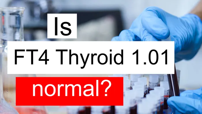 FT4 thyroid 1.01