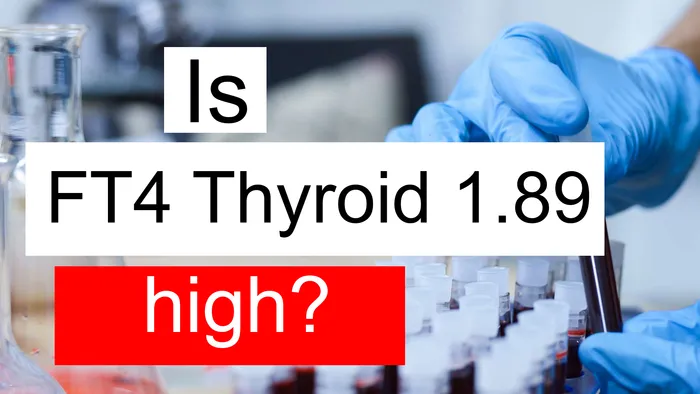 FT4 thyroid 1.89