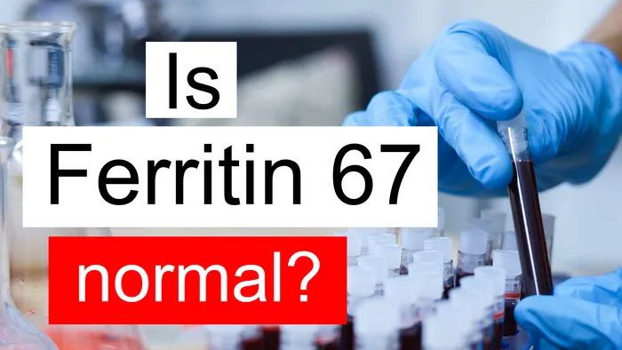 Ferritin 67