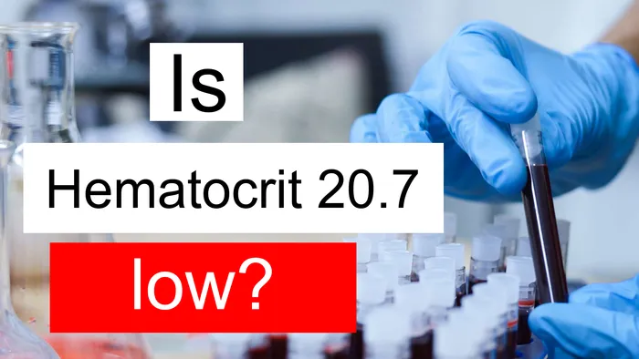 Hematocrit 20.7