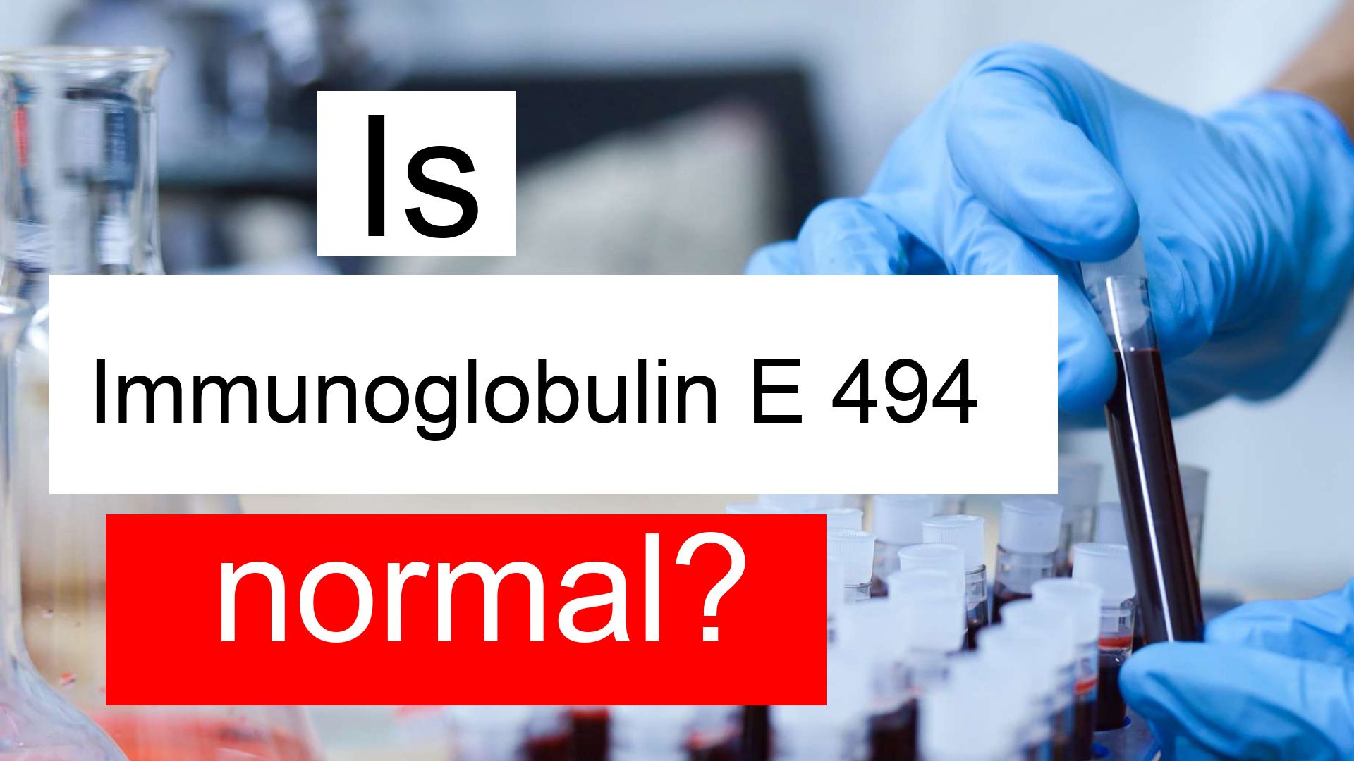 Is Immunoglobulin E 494 normal, high or low? What does IgE level 494 mean?