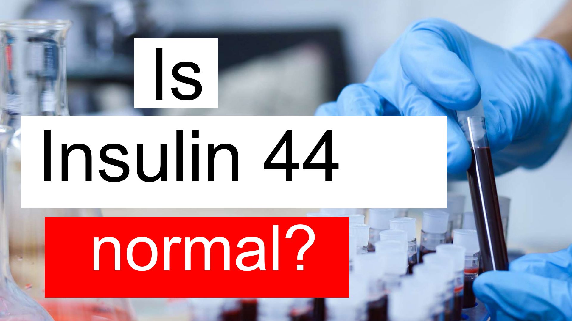 Is Insulin 44 High Normal Or Dangerous What Does Insulin Level 44 Mean 