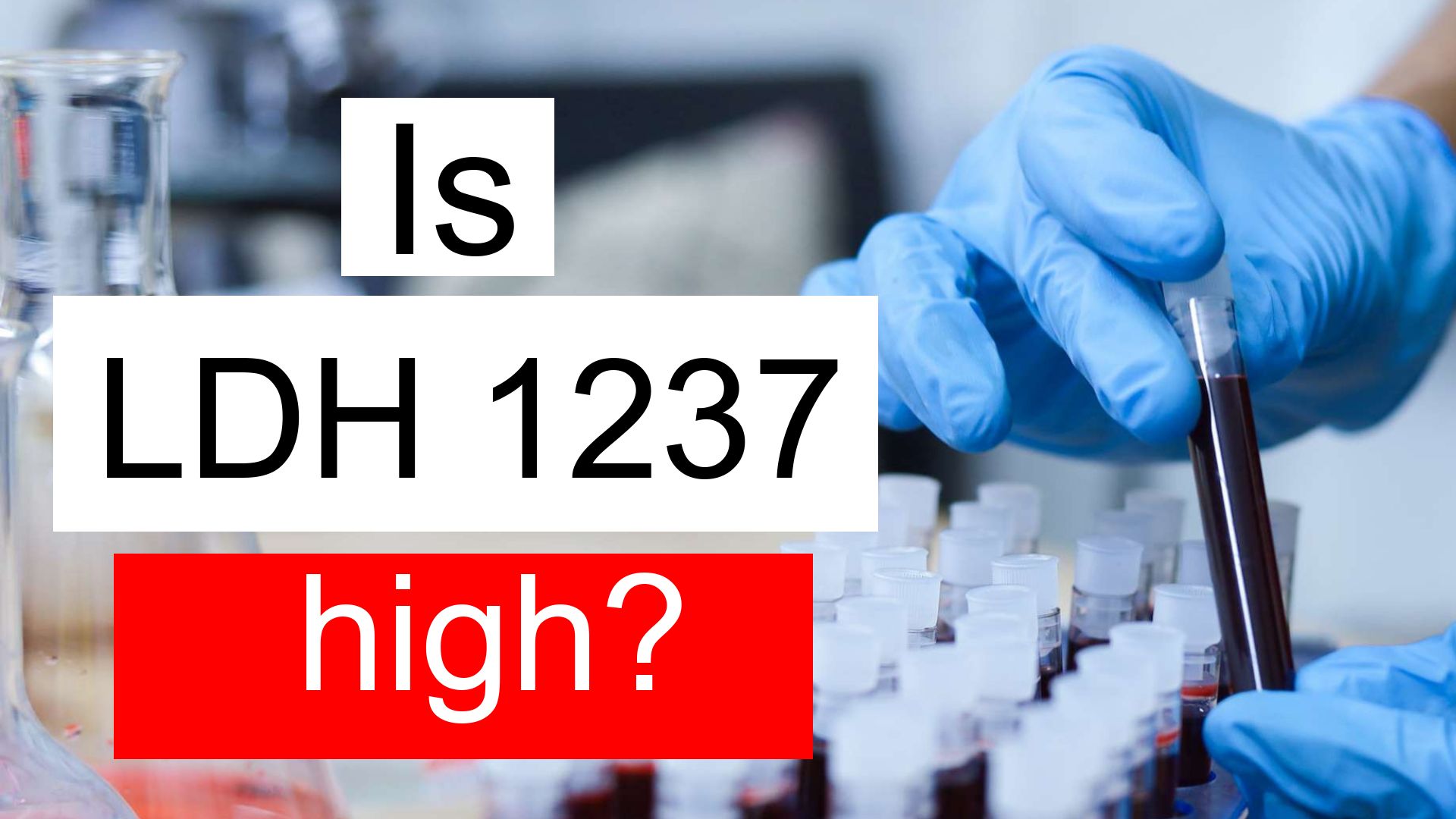 is-ldh-1237-high-normal-or-dangerous-what-does-lactate-dehydrogenase