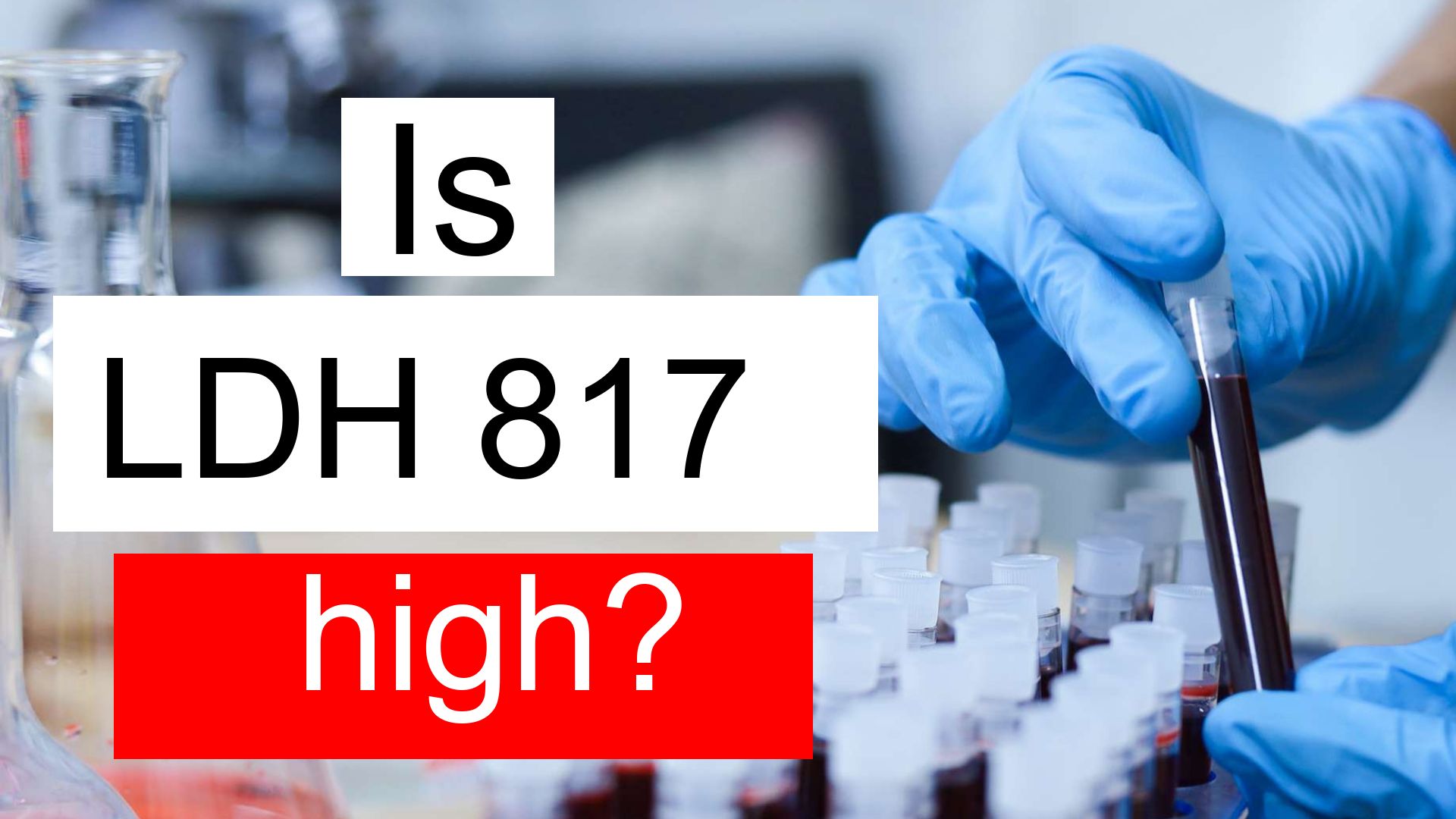 is-ldh-817-high-normal-or-dangerous-what-does-lactate-dehydrogenase