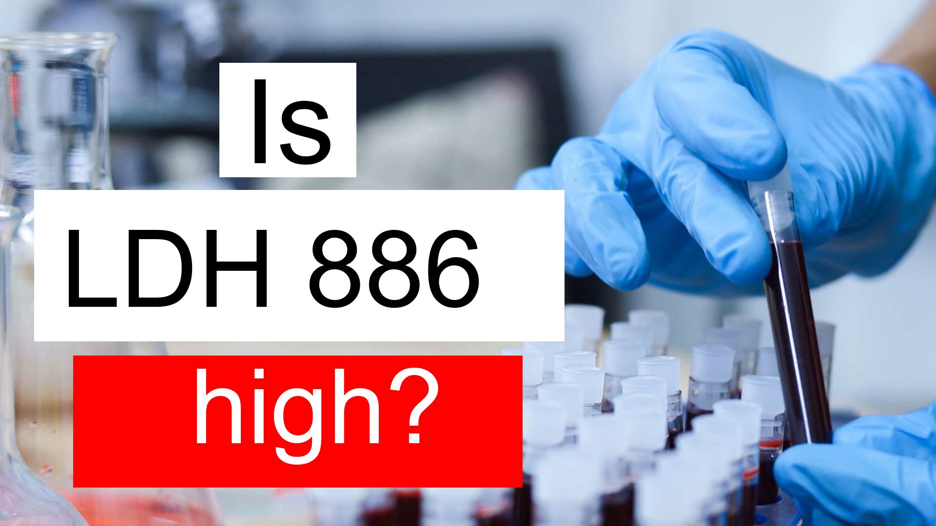 is-ldh-886-high-normal-or-dangerous-what-does-lactate-dehydrogenase