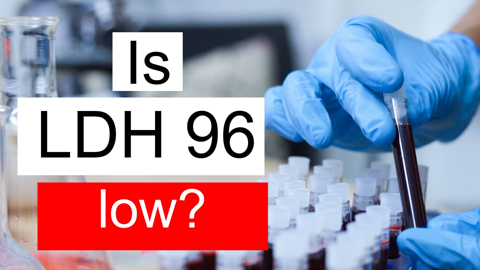 Is LDH 96 Low Normal Or Dangerous What Does Lactate Dehydrogenase 