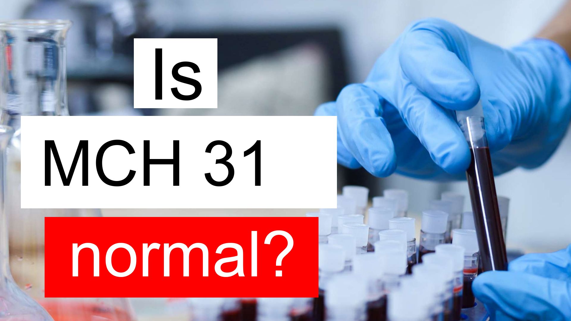 Is MCH 31 Normal High Or Low What Does Mean Corpuscular Hemoglobin 