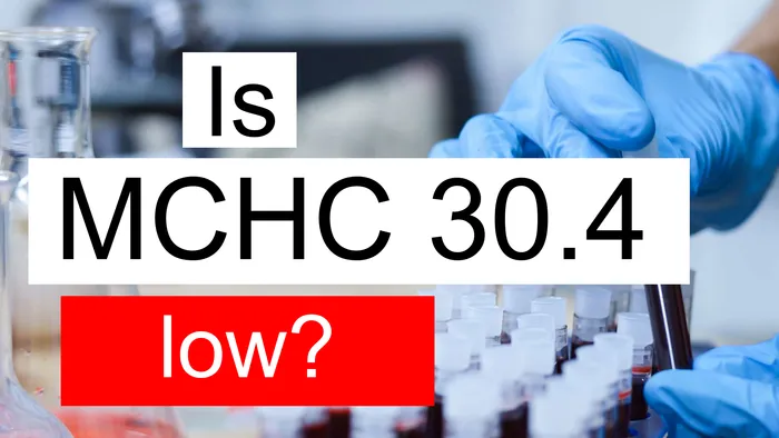 MCHC 30.4