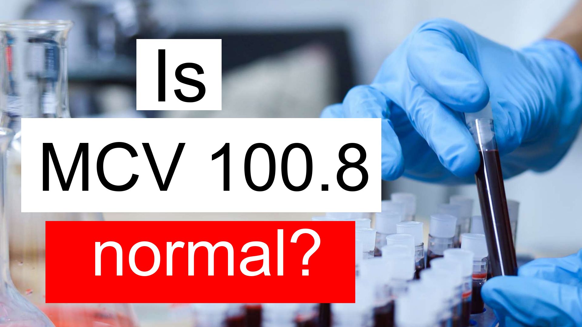 is-mcv-100-8-normal-high-or-low-what-does-mean-corpuscular-volume