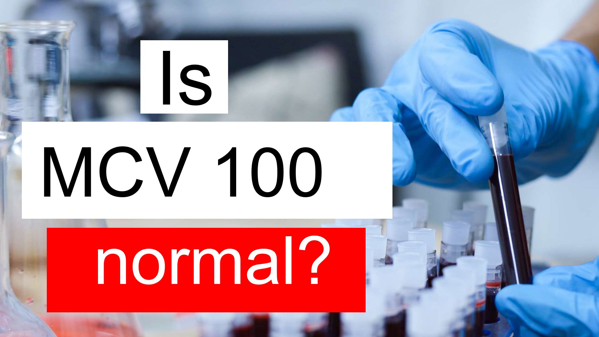 Is MCV 100 Normal High Or Low What Does Mean Corpuscular Volume Level 