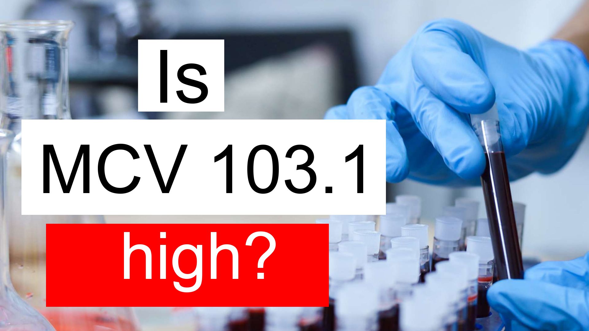 What Is A High Mcv Level