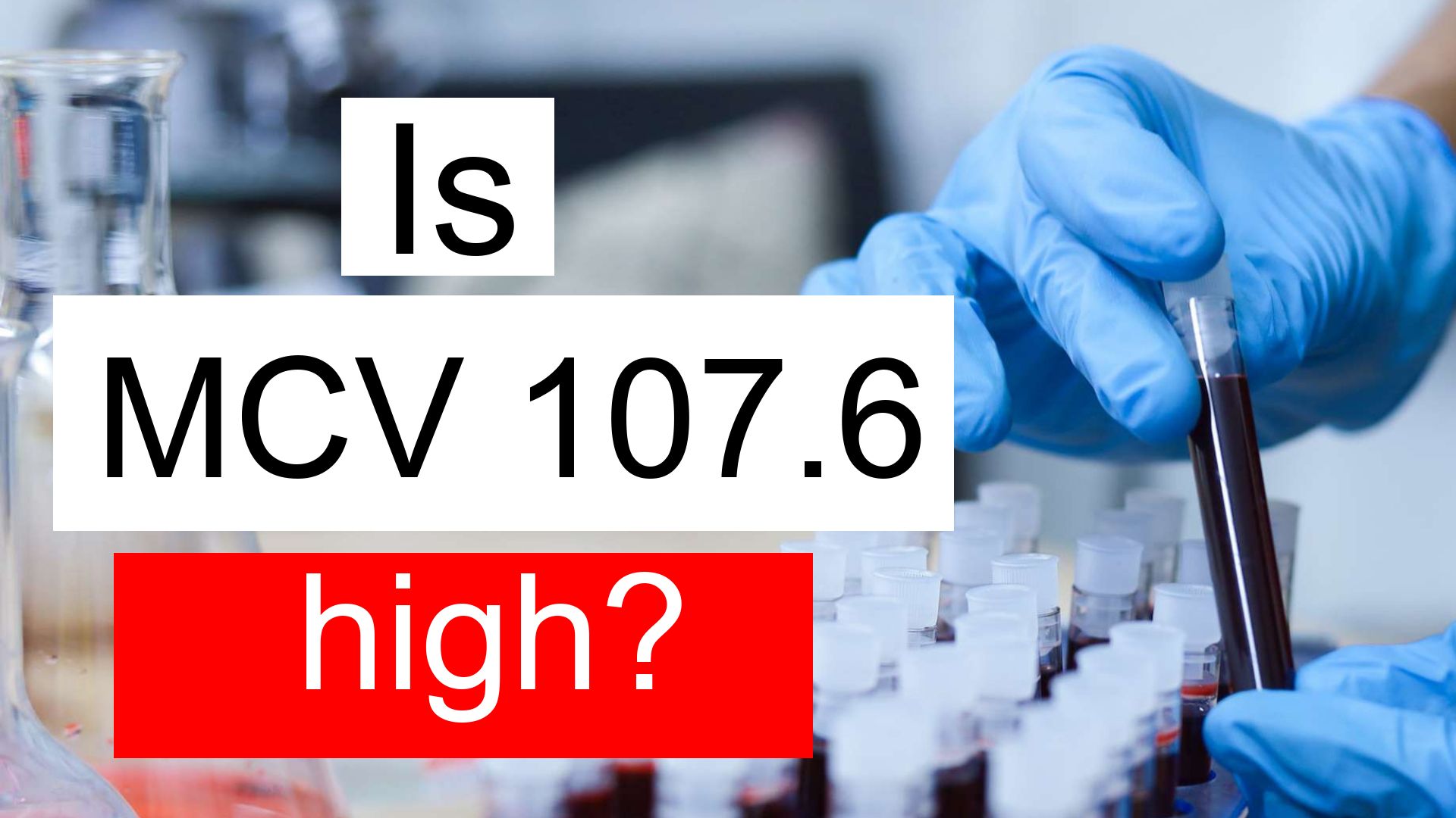 Is MCV 107 6 High Normal Or Dangerous What Does Mean Corpuscular 