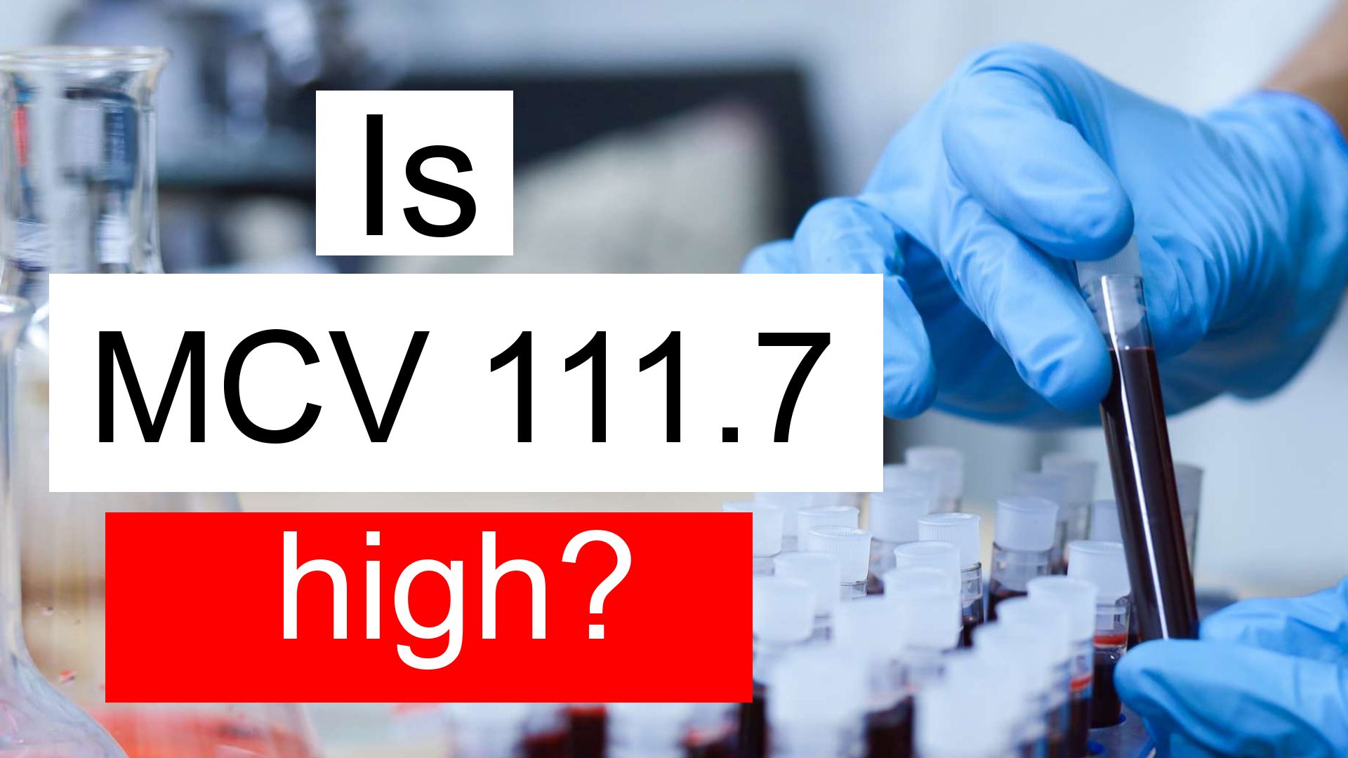 is-mcv-89-8-normal-high-or-low-what-does-mean-corpuscular-volume