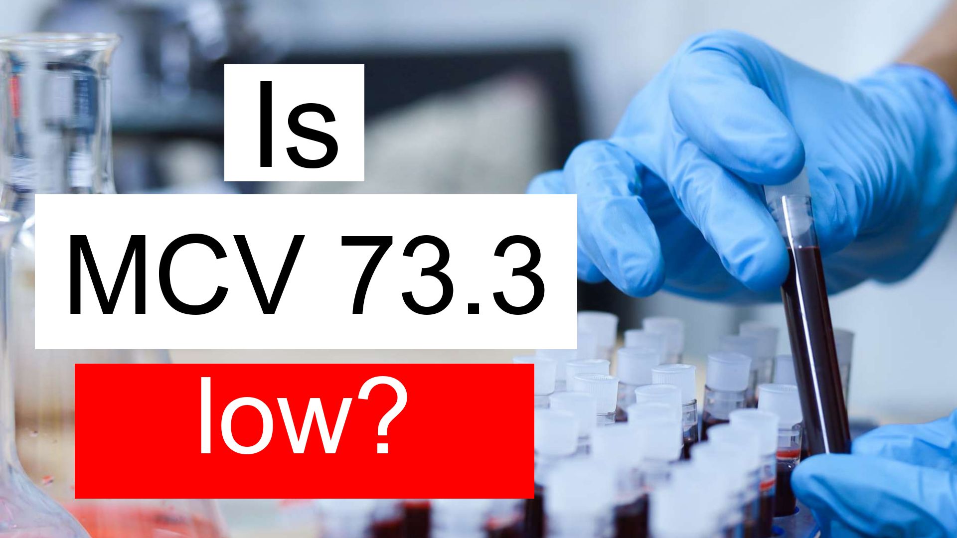 Is MCV 73 3 Low Normal Or Dangerous What Does Mean Corpuscular Volume 