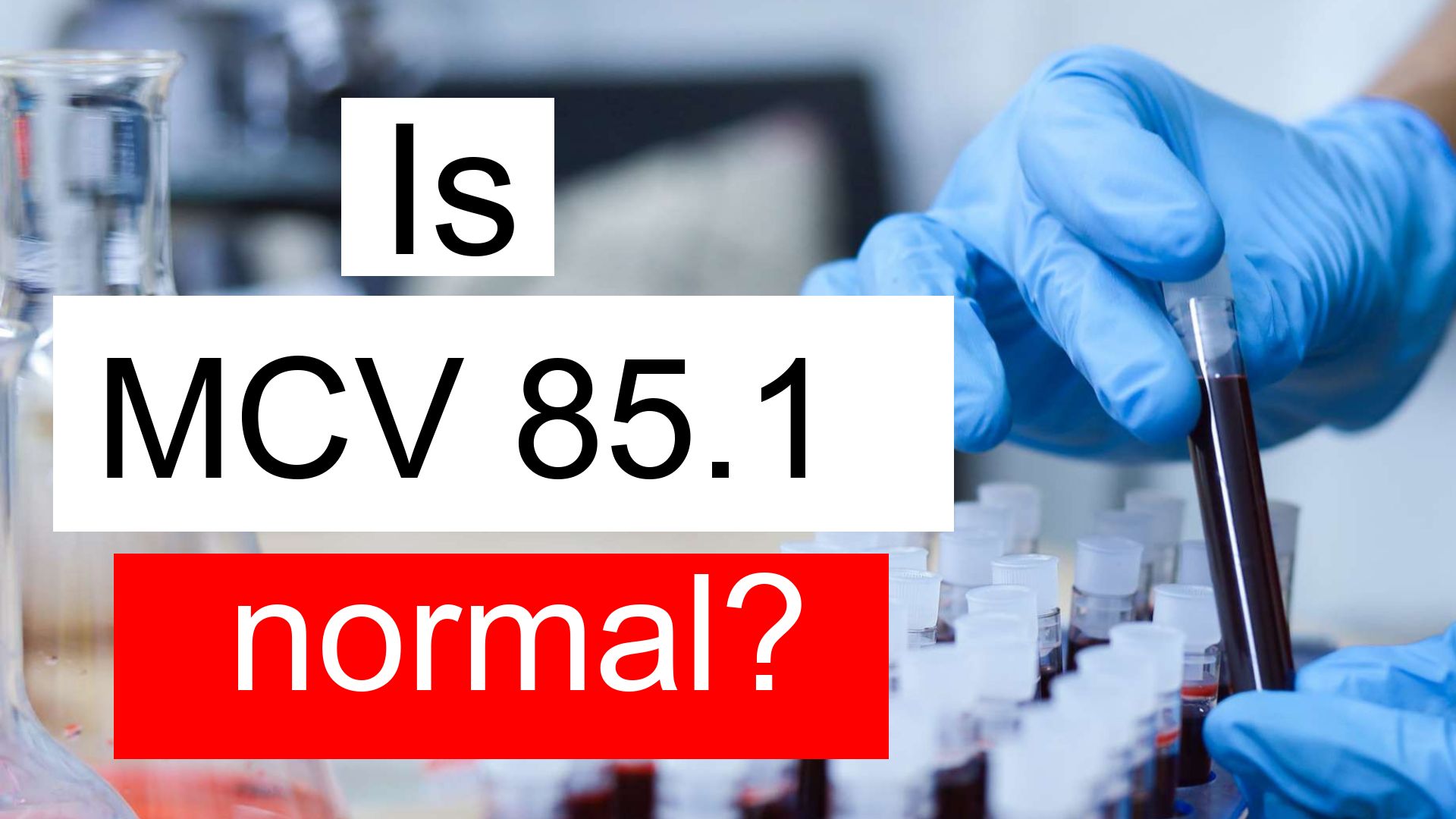 is-mcv-85-1-normal-high-or-low-what-does-mean-corpuscular-volume