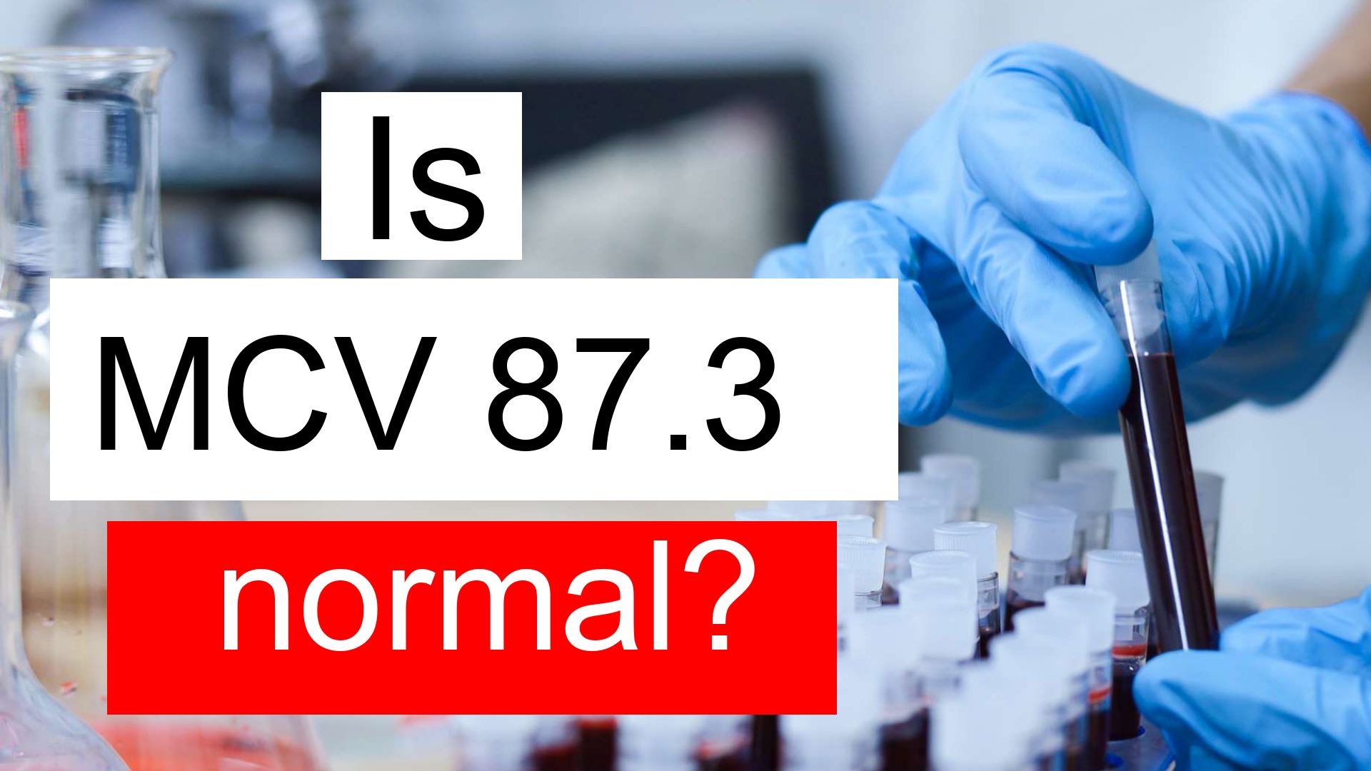 Is MCV 87 3 Normal High Or Low What Does Mean Corpuscular Volume 