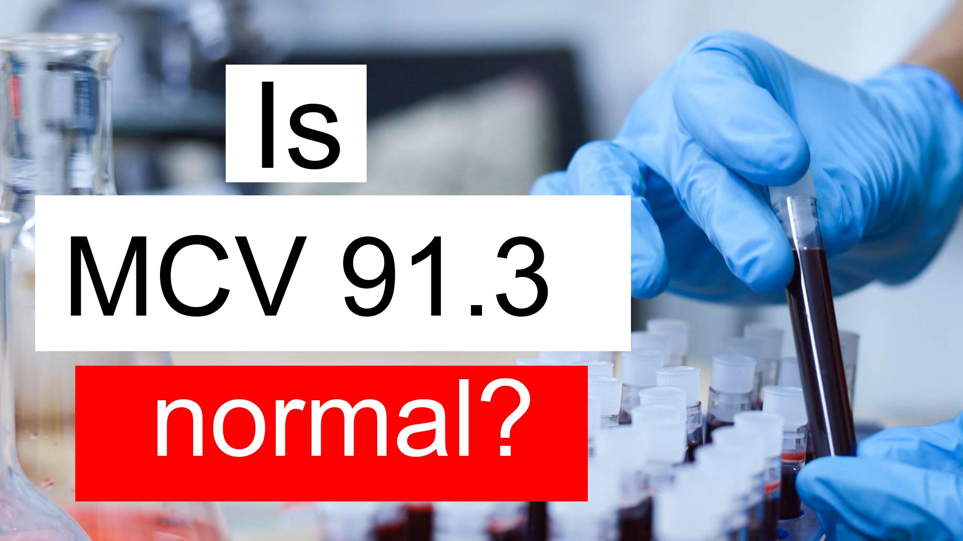 is-mcv-91-3-normal-high-or-low-what-does-mean-corpuscular-volume