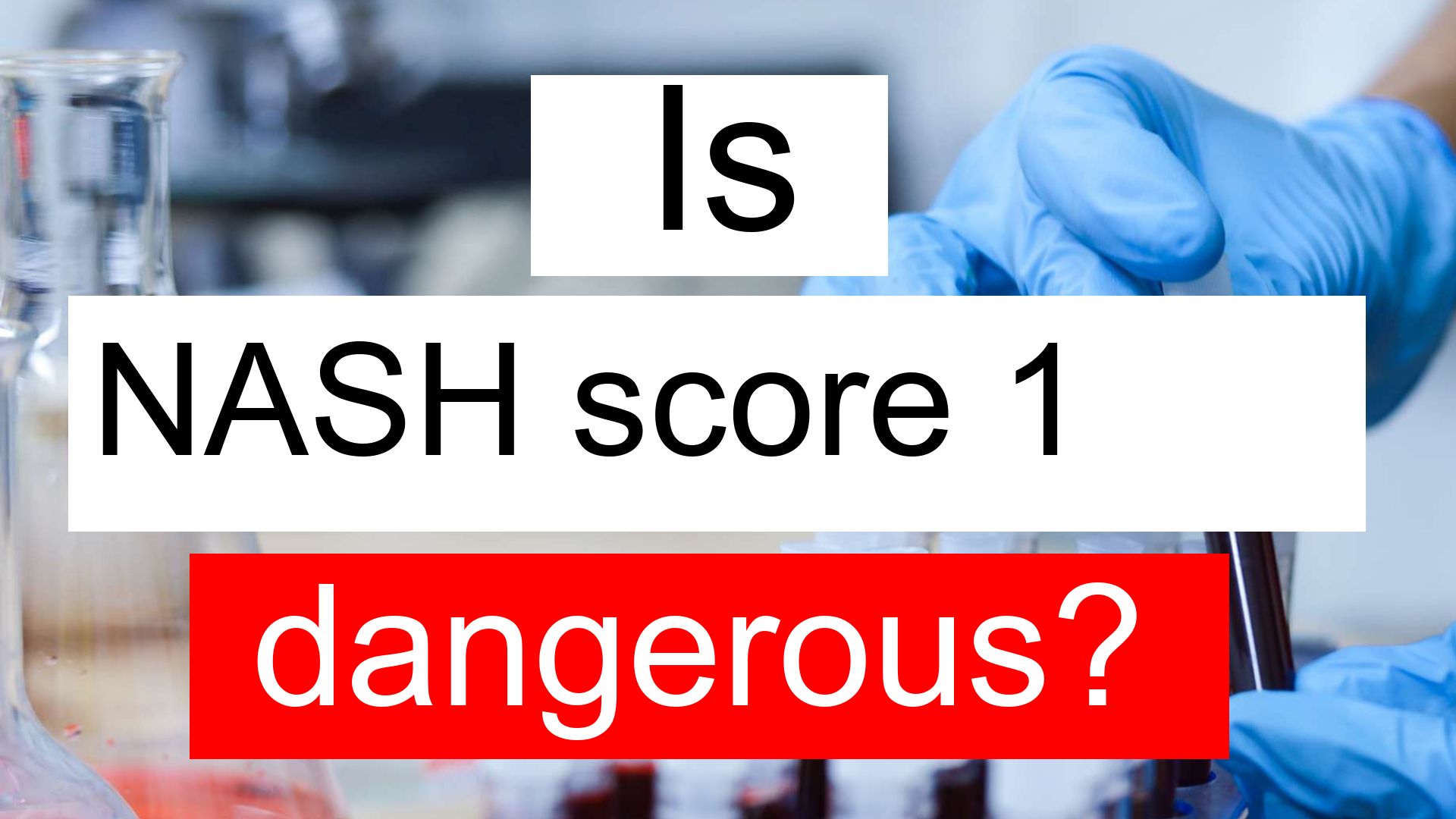 Is NASH score 1 high, normal or dangerous? What does NASH score level 1