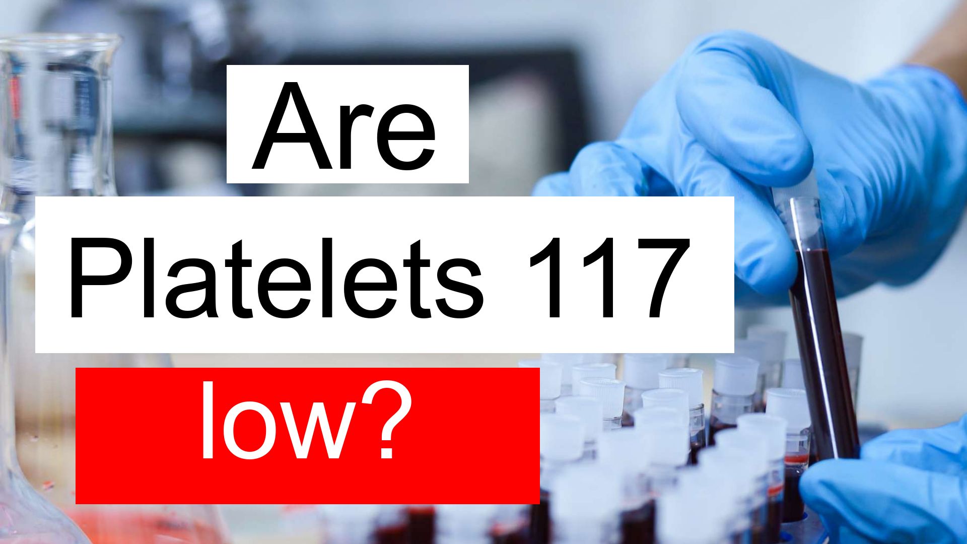 Is Platelet Count 117 Low, Normal Or Dangerous? What Does Platelet 