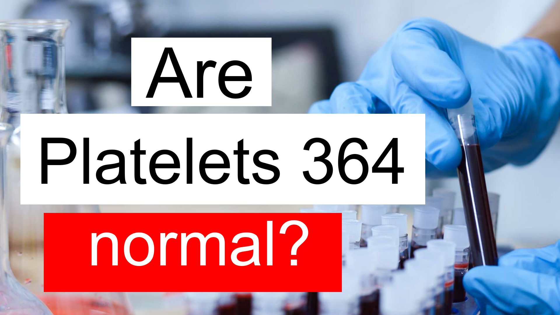 is-platelet-count-364-normal-high-or-low-what-does-platelet-count