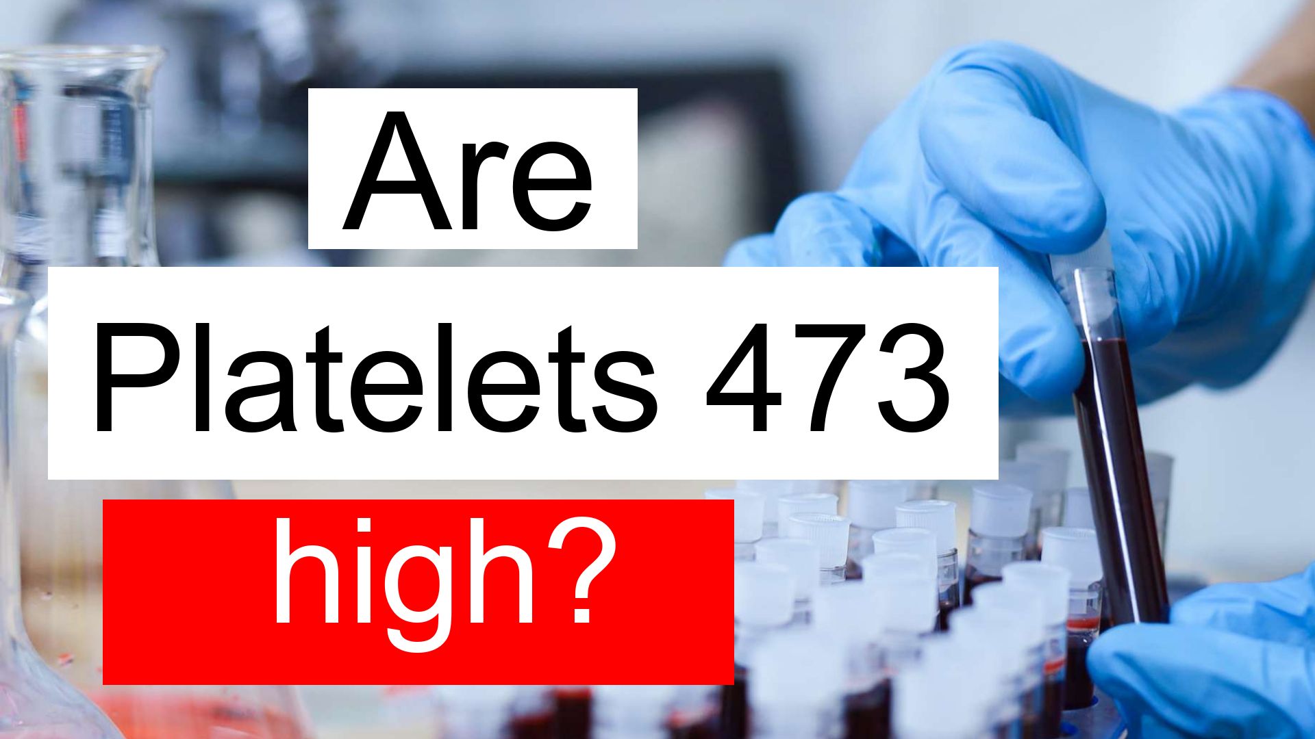 Lupus And High Platelet Count