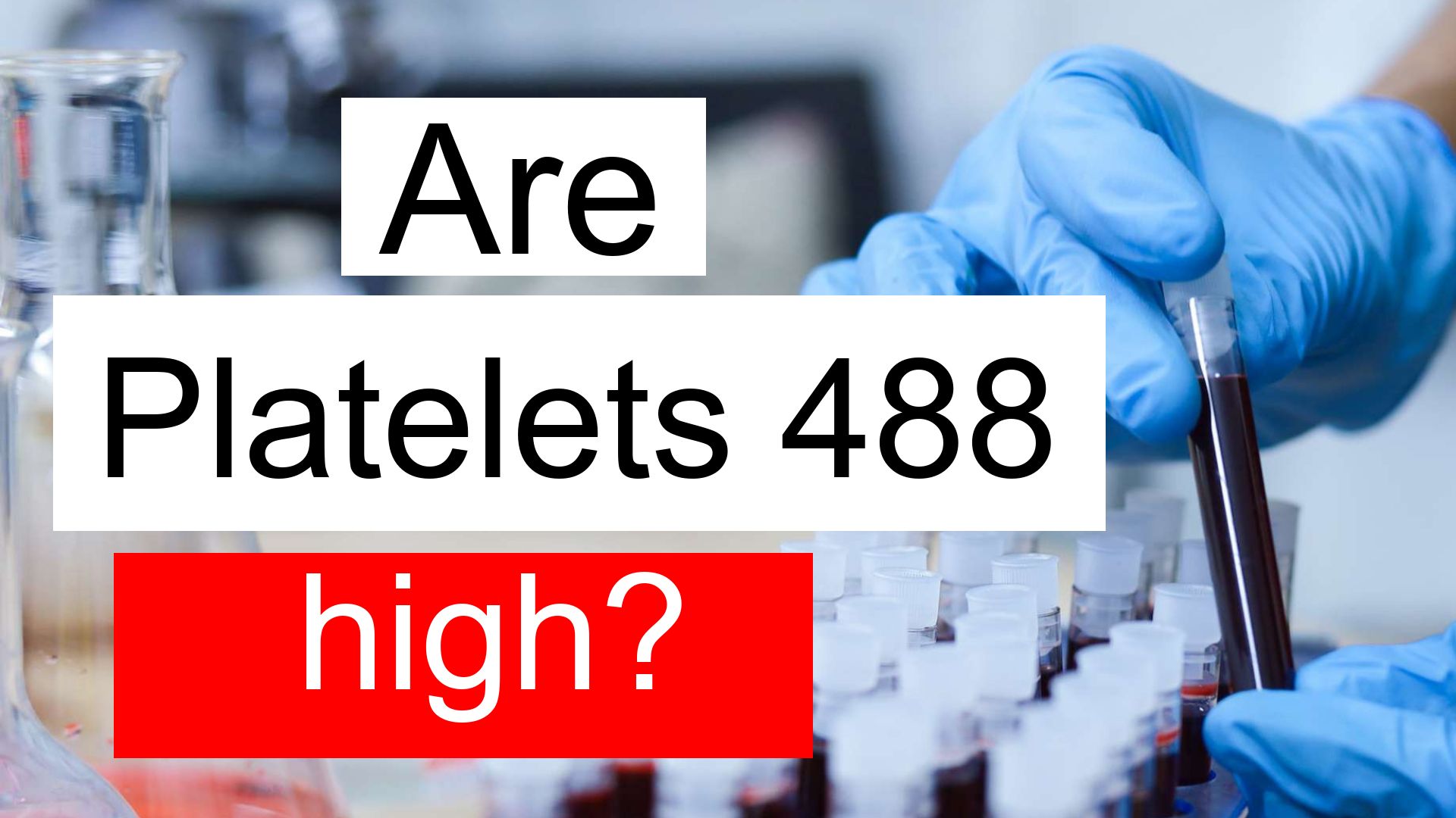 Is 488 A High Platelet Count