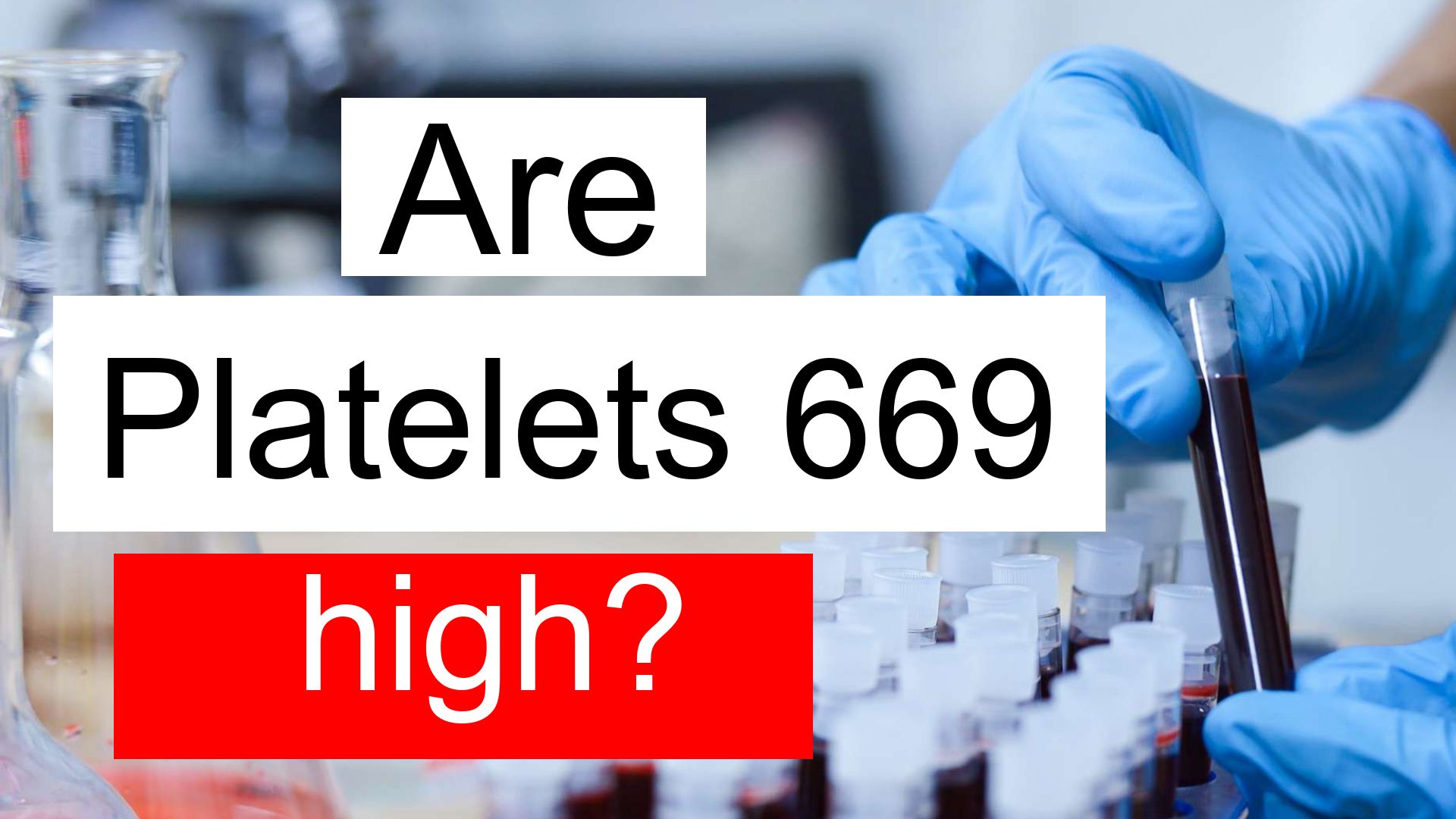 is-platelet-count-669-high-normal-or-dangerous-what-does-platelet-count-level-669-mean