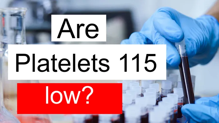 Platelet count 115