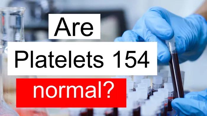 Platelet count 154