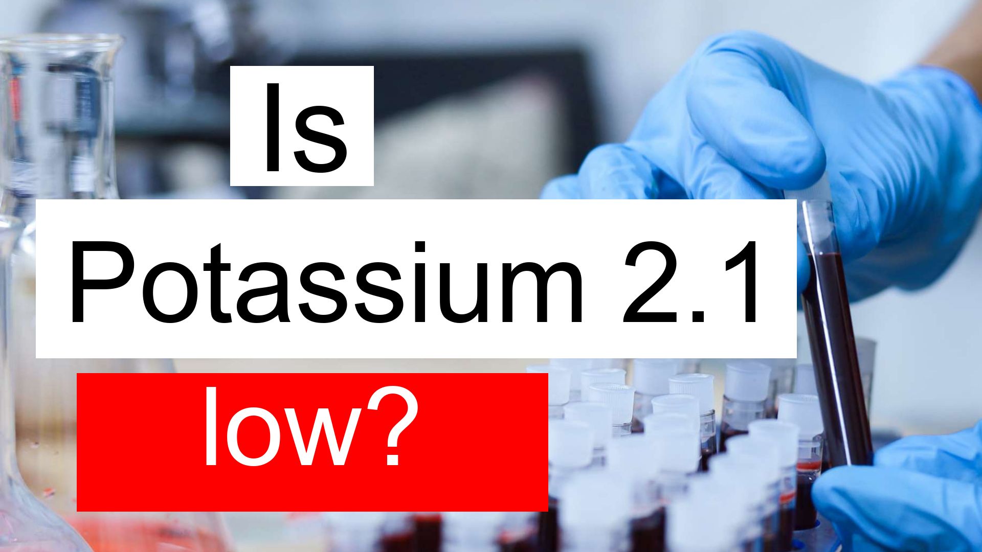 is-potassium-2-1-low-normal-or-dangerous-what-does-potassium-level-2